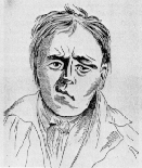 Bell's palsy (19th cent)